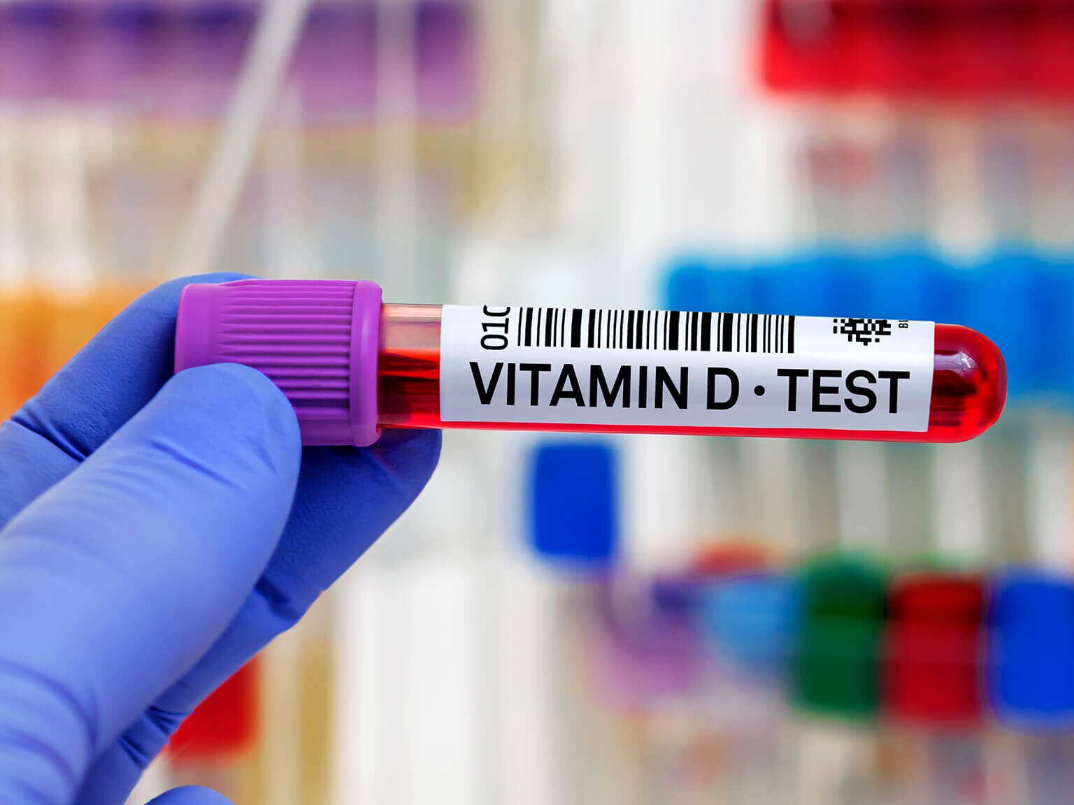 Laborprobe mit Vitamin-D Test Aufschrift